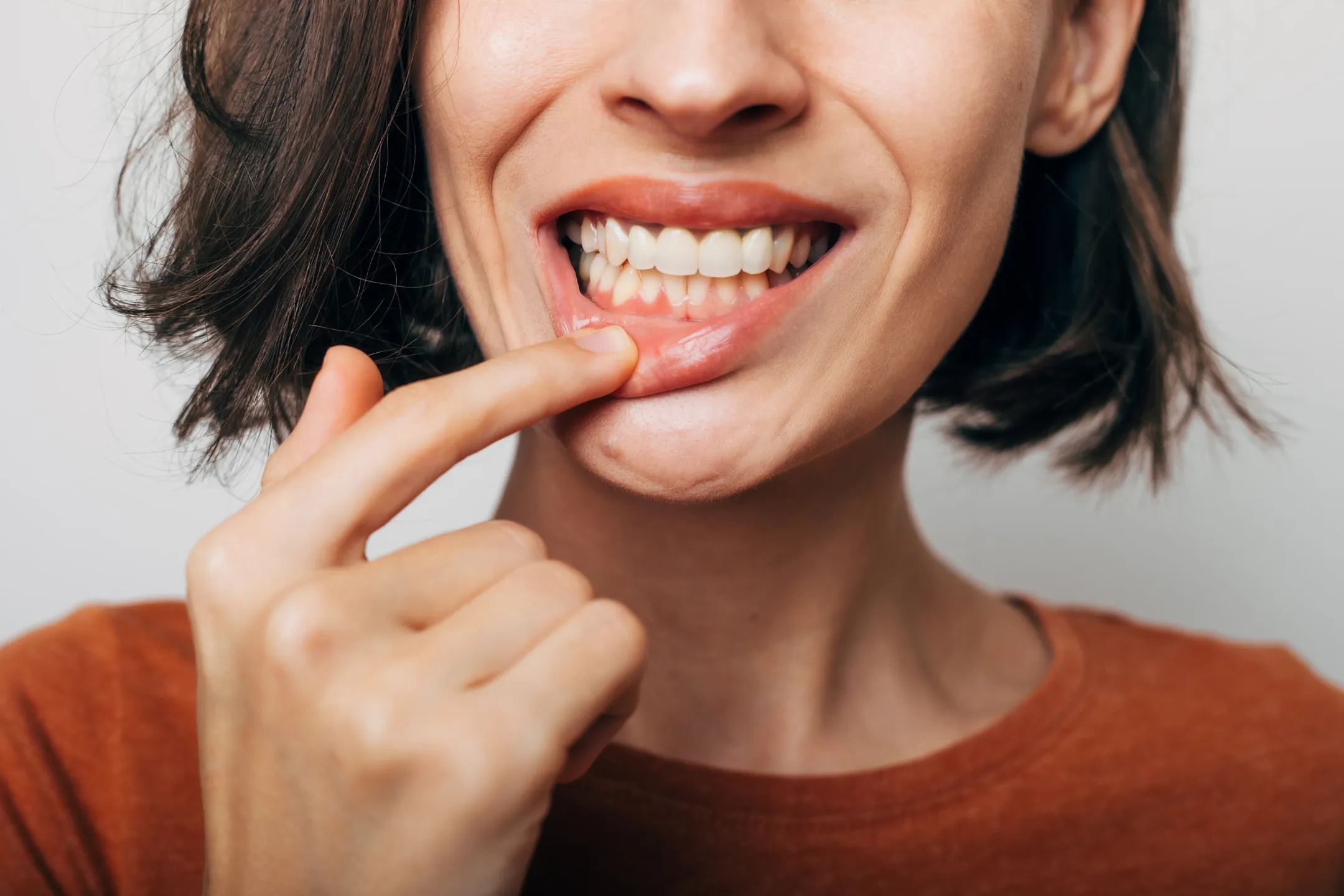 Gum Disease / Periodontal Treatment